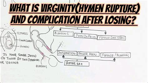 hymen video|Virginity + Hymen types and causes of Hymen rupture